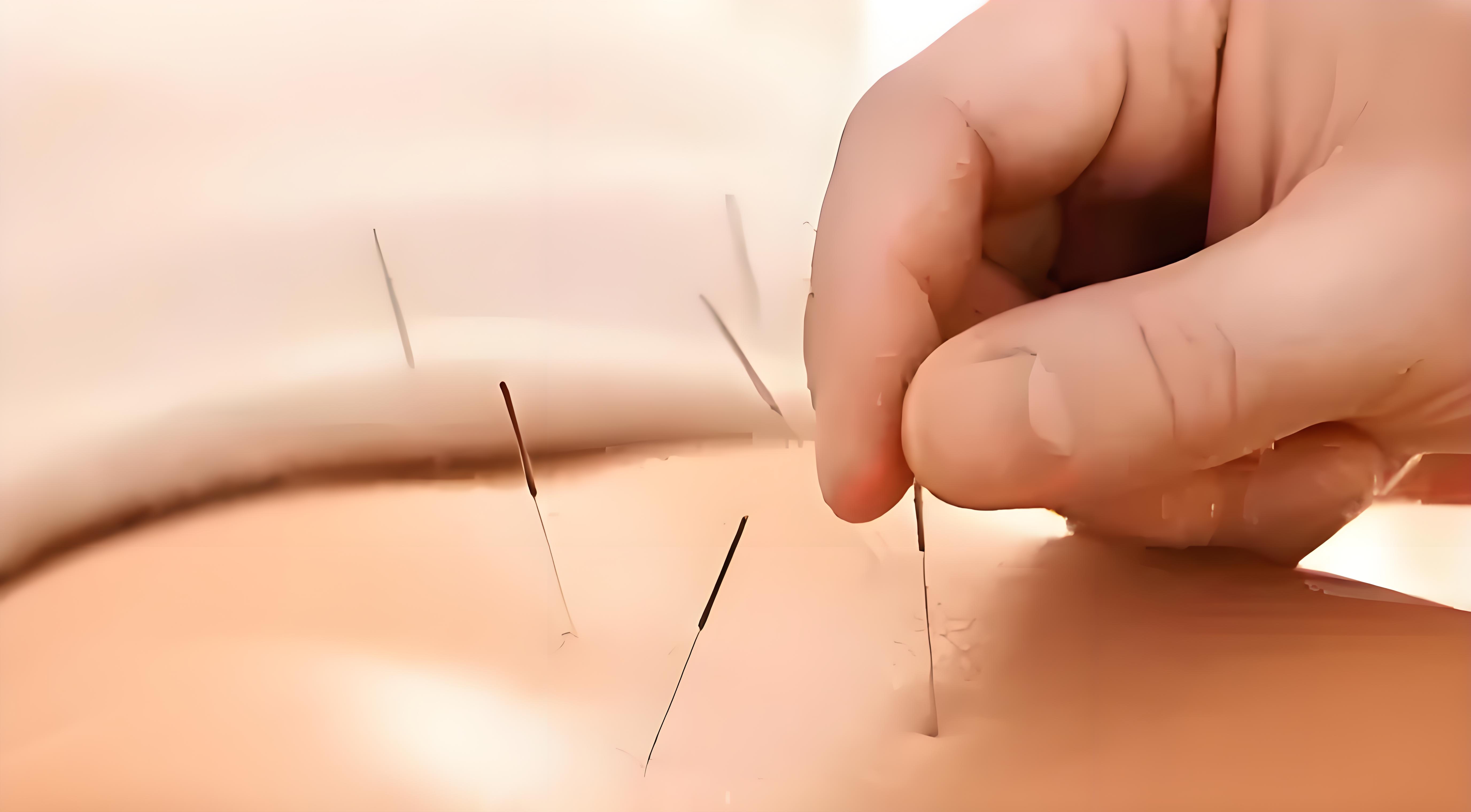 雷竞技最新下载地址三