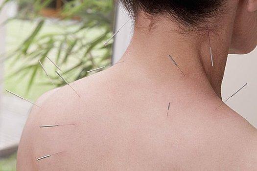 颈椎病患者的新希望：雷竞技最新下载地址治疗的惊人效果