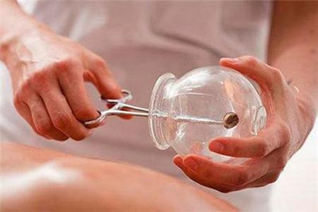 哈尔滨中医拔罐哪家好