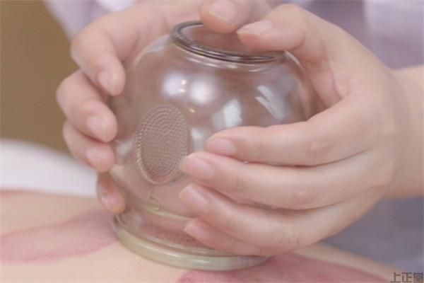 发烧咳嗽扁桃体炎拔罐有效吗