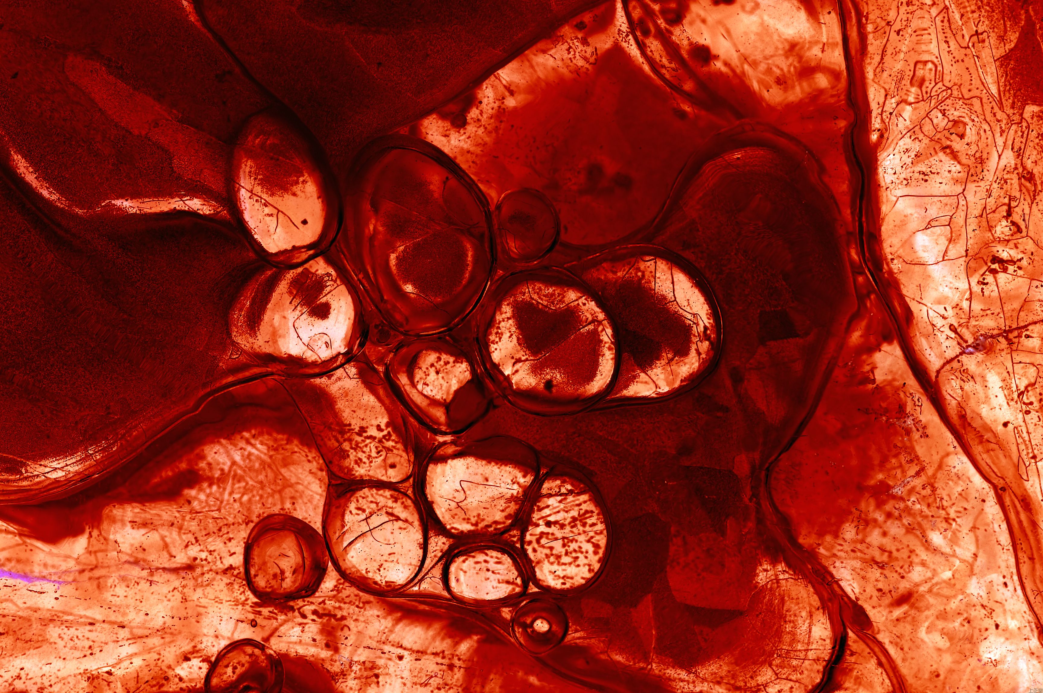 痰的颜色不同表现