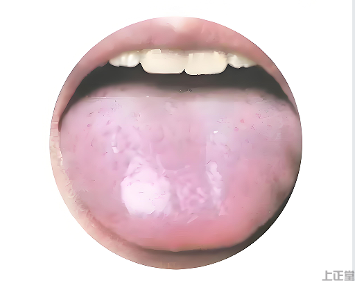 养生资讯!脾胃不好如何通过舌苔能看出来